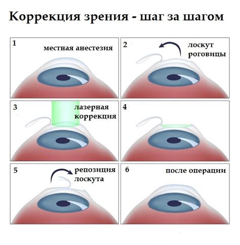 Коррекция зрения и преимущества использования очков