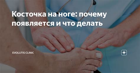 Косточка на ноге: что это такое и почему она появляется?