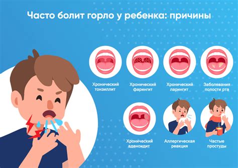 Красное горло: 7 способов