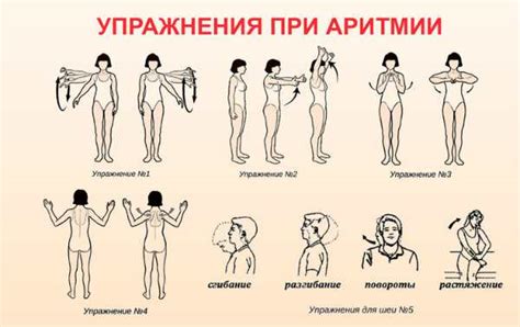 Критерии выбора упражнений при аритмии