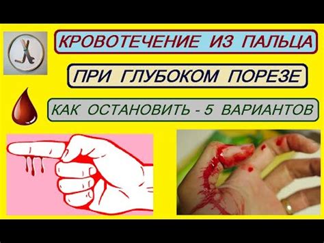 Кровотечение из пальца: причины и что делать