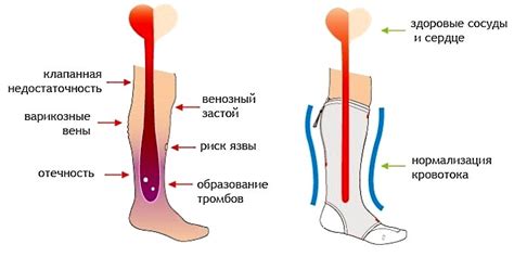 Кровоток как одна из причин онемения ноги из бедра