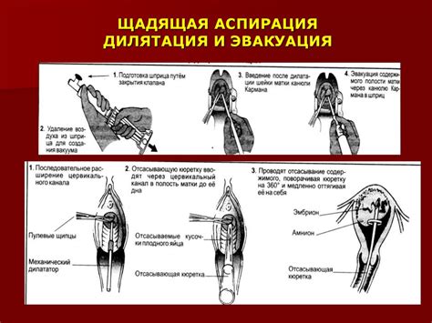 Купание после вакуумной аспирации