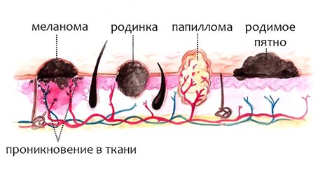 Лечение ВПЧ у мужчин: эффективные методы и процедуры