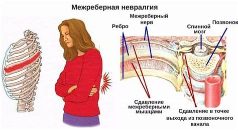 Лечение боли и жжения в области правой лопатки сзади: