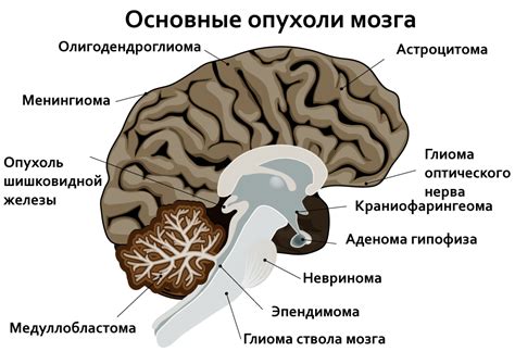 Лечение доброкачественной опухоли головного мозга