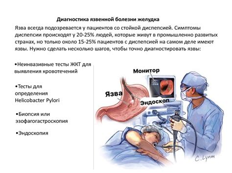 Лечение и профилактика язвы желудка