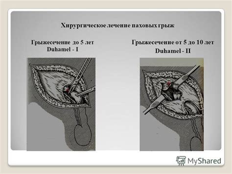 Лечение неопущенного яичка