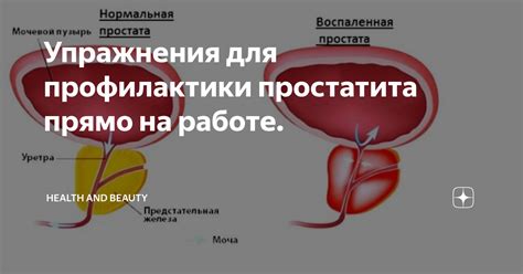 Лечение повышенного содержания железа у мужчин