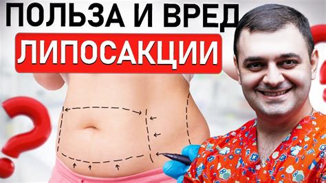 Липосакция: эффективный метод удаления жира