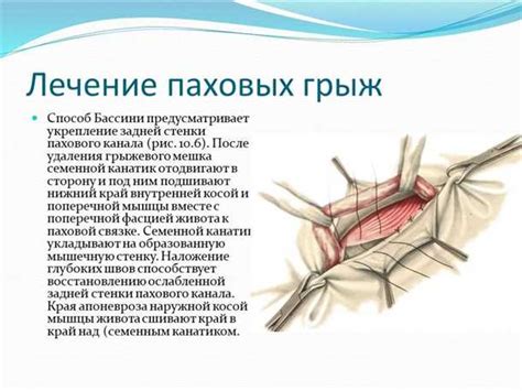 Массаж при паховой грыже у детей: основной метод воздействия