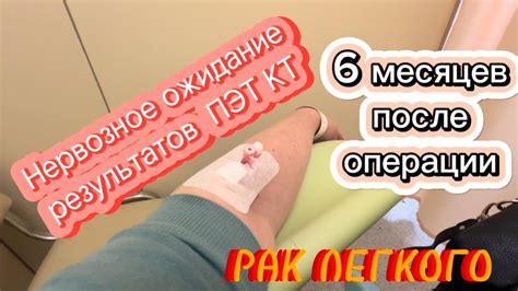 Медикаментозные методы улучшения расправления легкого после операции