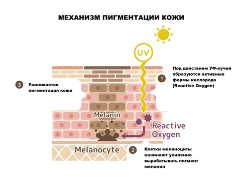 Меланиновые дефекты