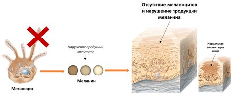 Меланин и его роль в определении цвета кожи