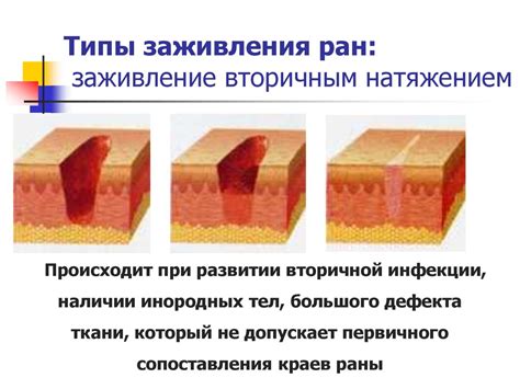 Меры предосторожности и уход за ранами после заживления