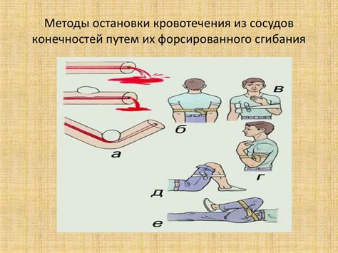 Меры предотвращения кровотечений