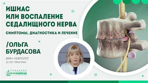 Методы восстановления седалищного нерва