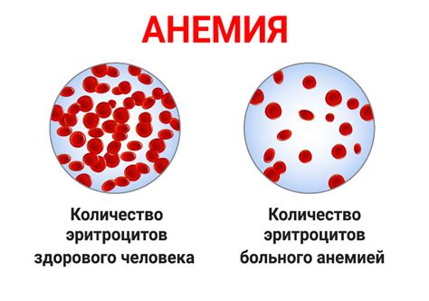 Методы диагностики анемии