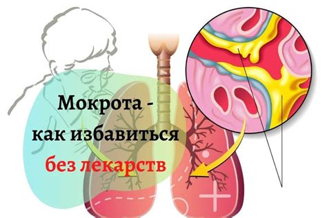 Методы избавления ребенка от мокроты без лекарств