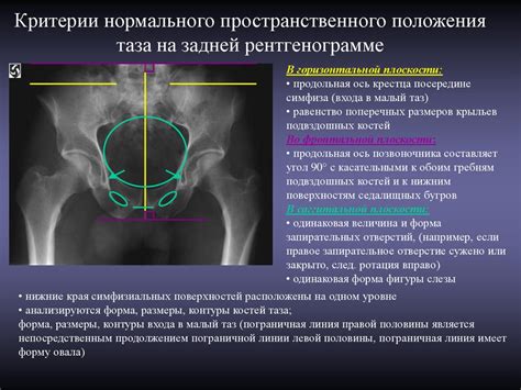 Методы и процедуры уменьшения таза