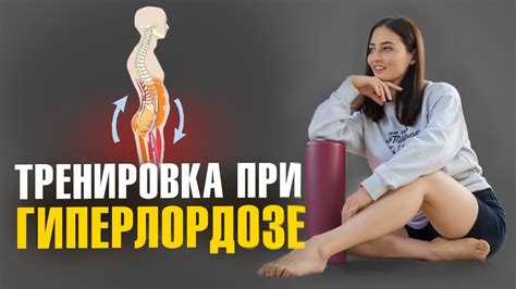 Методы и упражнения для лечения гиперлордоза