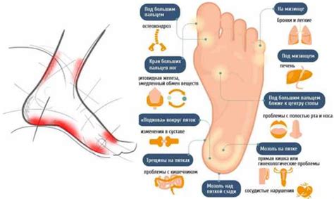 Методы лечения и профилактика боли в пальцах на левой ноге