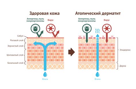 Методы лечения облазения кожи на пальцах ног при атопическом дерматите