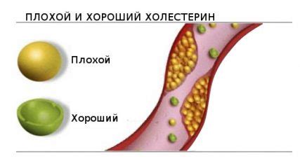 Методы лечения повышенных триглицеридов