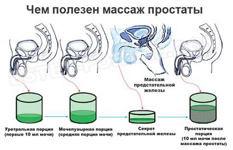 Методы массажа простаты