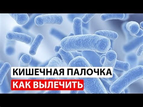 Методы определения кишечной палочки в домашних условиях