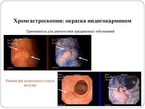 Методы определения ушиба: как провести диагностику?