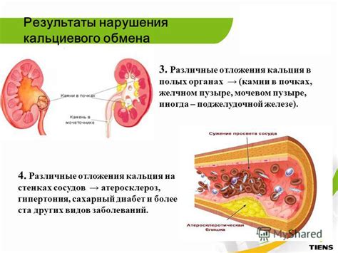 Методы предотвращения и уменьшения отложения кальция на стенках сосудов