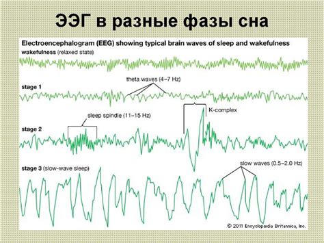 Методы распознавания состояния сна