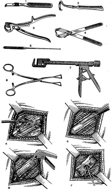 Метод #5: Использование специальных инструментов