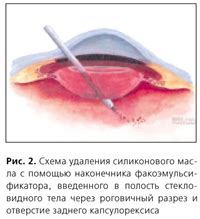 Метод испытания с помощью силиконового масла