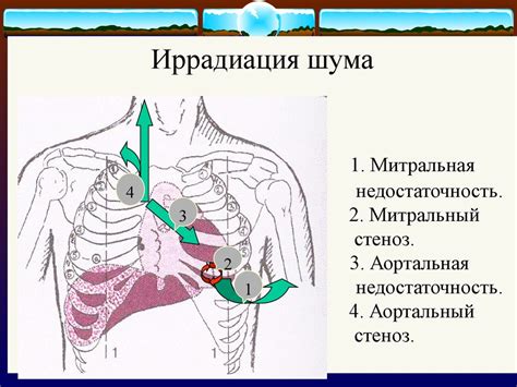 Механизмы возникновения