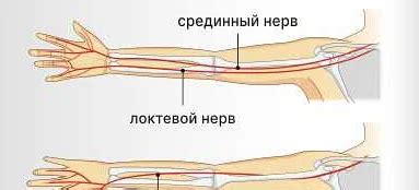 Механизмы возникновения онемения и потери чувствительности в руке