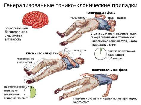 Механизмы возникновения приступов эпилепсии во время сна