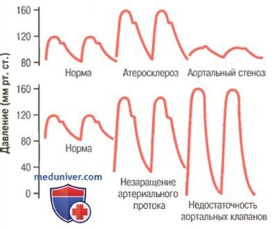 Механизмы изменения пульсового давления во время физической нагрузки