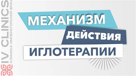 Механизм действия иглоукалывания