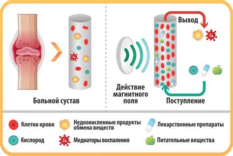 Механизм действия магнитотерапии