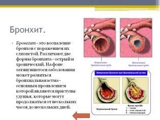 Механизм действия сосудосуживающих капель