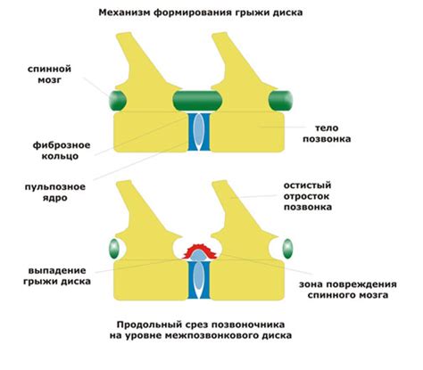 Механизм образования кольца