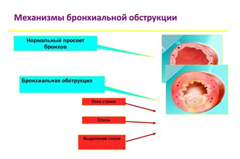 Механизм образования слизи в горле