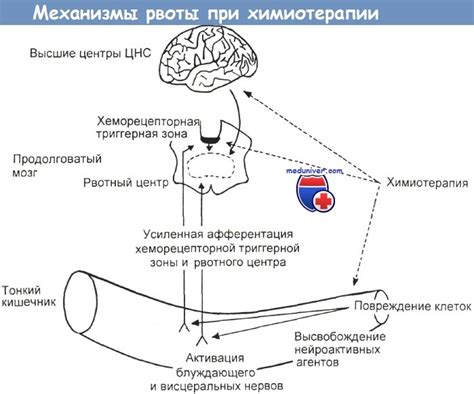 Механизм рвоты у человека