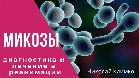 Микозы и инфекции