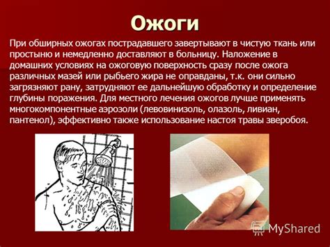 Мифы о волдырях после ожога