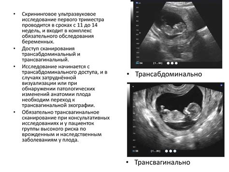 Мифы о полетах и беременности в первом триместре