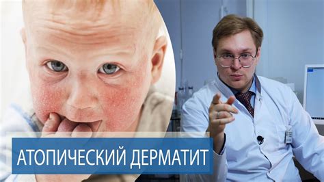 Миф или реальность: банан и диатез у ребенка