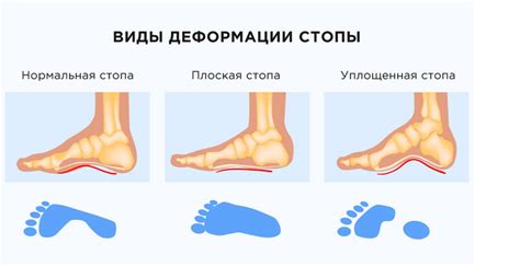 Младенцы и потение стоп: что нужно знать